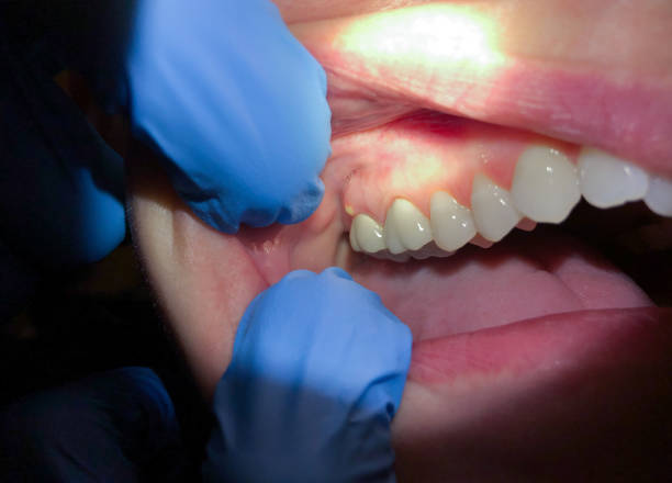 Best Pediatric Emergency Dentist in Perryton, TX