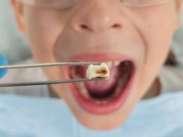 Best Pediatric Emergency Dentist in Perryton, TX